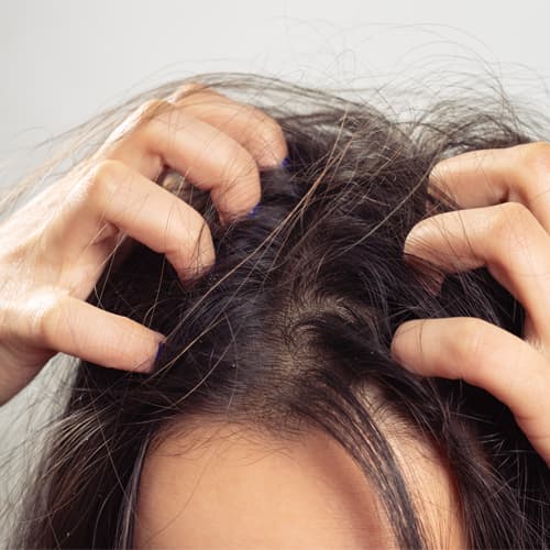 Dry Scalp
