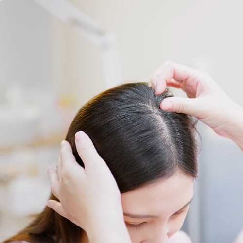 Normal Scalp