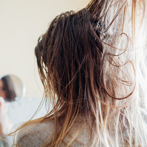 Oily Scalp