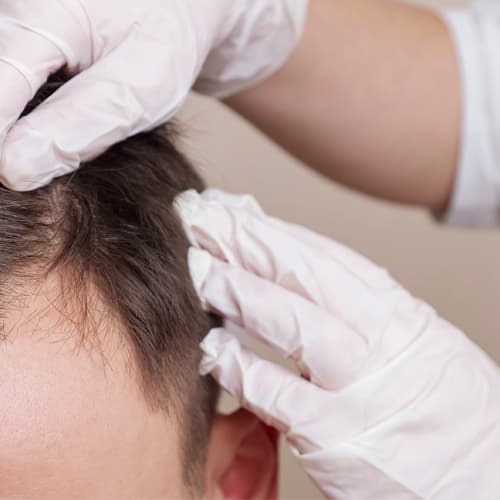 Scalp Care Series